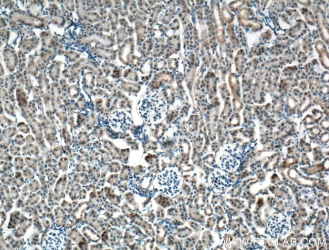 SLC22A7 Antibody in Immunohistochemistry (Paraffin) (IHC (P))