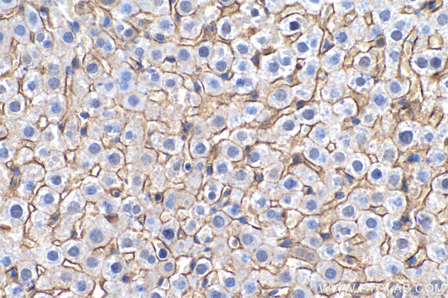 SLC22A7 Antibody in Immunohistochemistry (Paraffin) (IHC (P))