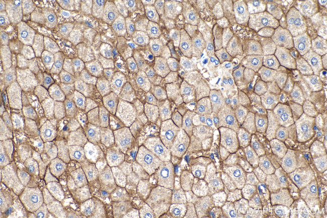 SLC22A7 Antibody in Immunohistochemistry (Paraffin) (IHC (P))