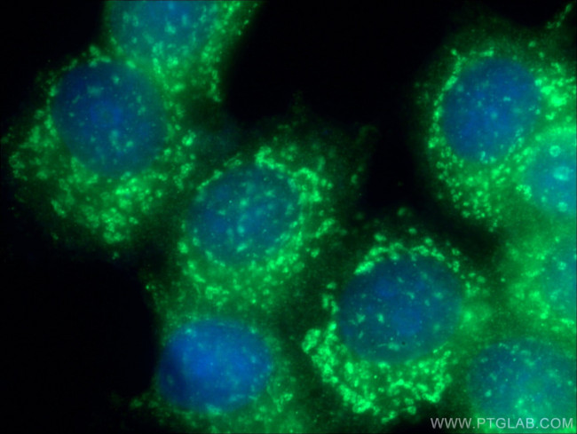 GPSM2 Antibody in Immunocytochemistry (ICC/IF)