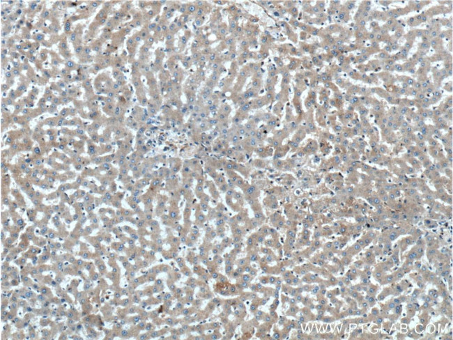 GPSM2 Antibody in Immunohistochemistry (Paraffin) (IHC (P))