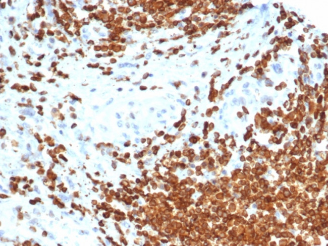 Anti Mullerian Hormone (AMH)/Mullerian Inhibiting Substance (MIS) Antibody in Immunohistochemistry (Paraffin) (IHC (P))