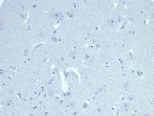 Anti Mullerian Hormone (AMH)/Mullerian Inhibiting Substance (MIS) Antibody in Immunohistochemistry (Paraffin) (IHC (P))