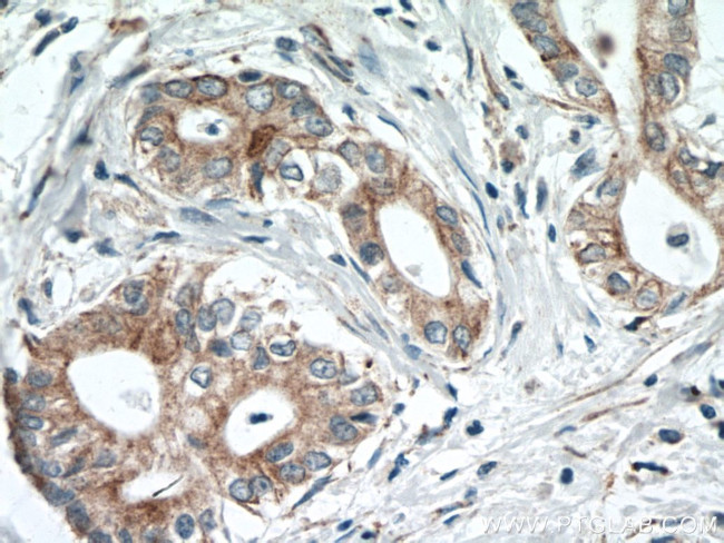 SLC25A12 Antibody in Immunohistochemistry (Paraffin) (IHC (P))