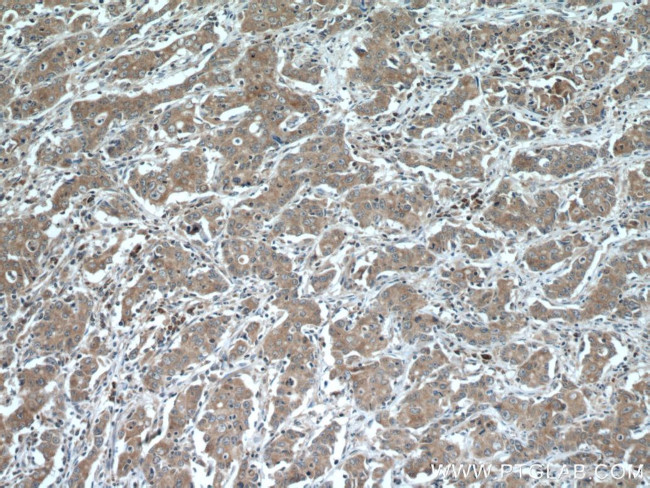 SLC25A12 Antibody in Immunohistochemistry (Paraffin) (IHC (P))