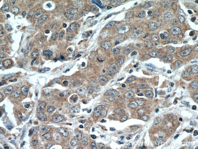 SLC25A12 Antibody in Immunohistochemistry (Paraffin) (IHC (P))