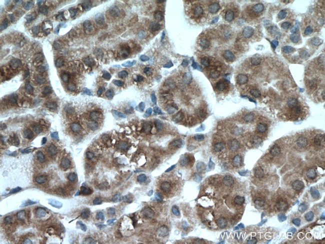 SLC25A12 Antibody in Immunohistochemistry (Paraffin) (IHC (P))