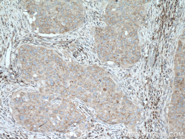 SLC25A12 Antibody in Immunohistochemistry (Paraffin) (IHC (P))