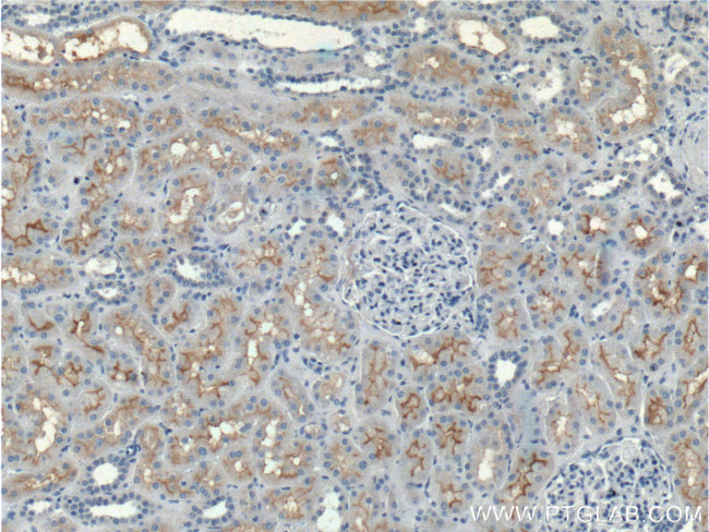 CLCN5 Antibody in Immunohistochemistry (Paraffin) (IHC (P))