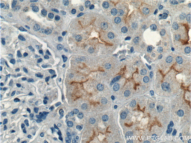 CLCN5 Antibody in Immunohistochemistry (Paraffin) (IHC (P))