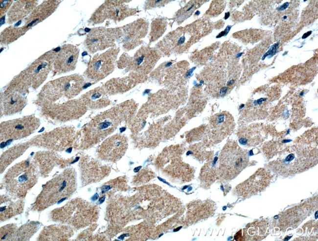 SAMD8 Antibody in Immunohistochemistry (Paraffin) (IHC (P))