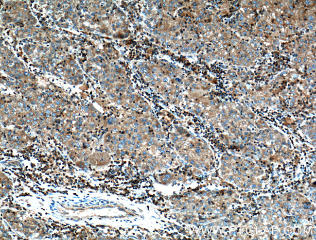 SAMD8 Antibody in Immunohistochemistry (Paraffin) (IHC (P))