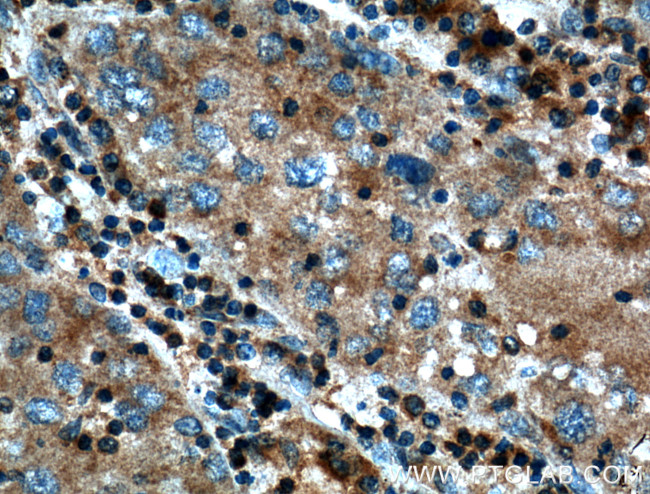 SAMD8 Antibody in Immunohistochemistry (Paraffin) (IHC (P))