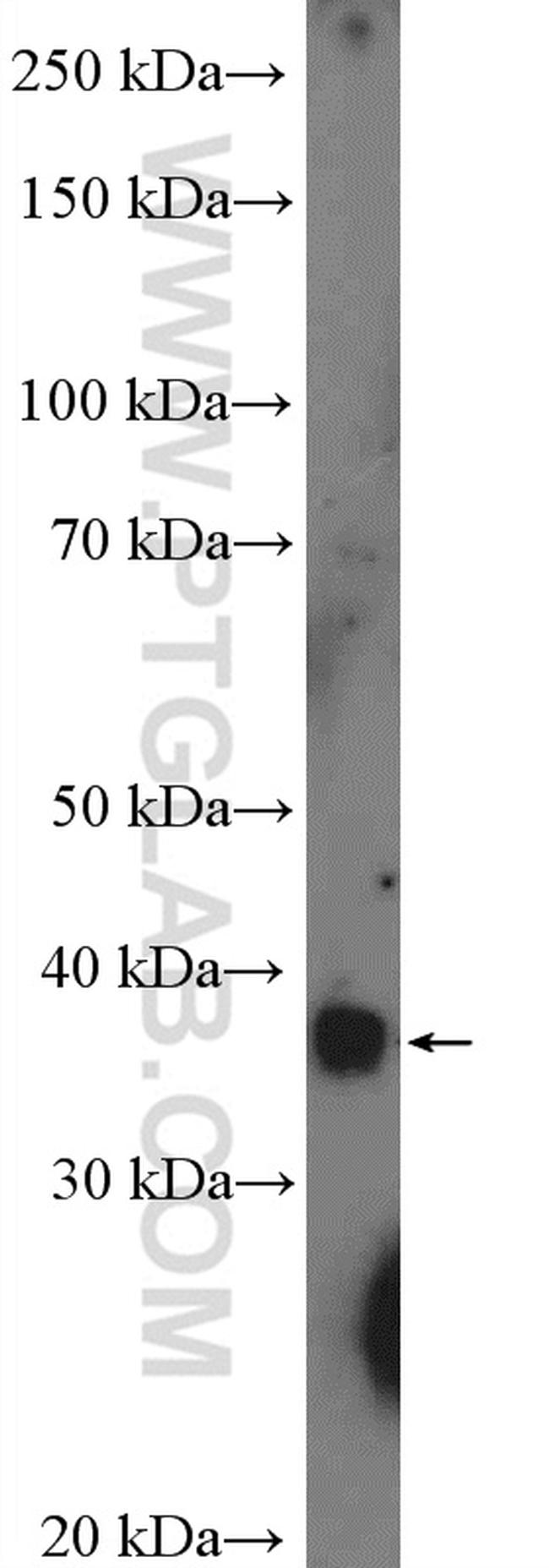 SAMD8 Antibody in Western Blot (WB)