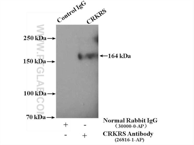 CRKRS Antibody in Immunoprecipitation (IP)