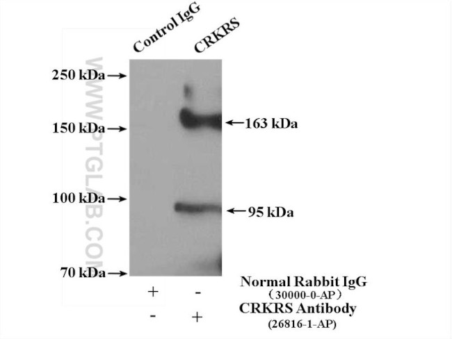 CRKRS Antibody in Immunoprecipitation (IP)