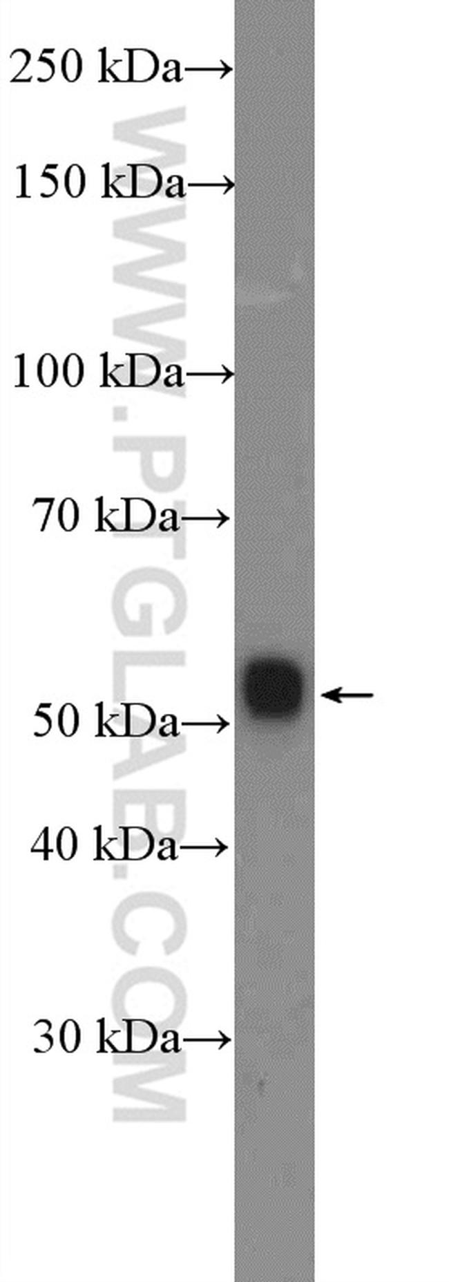 WDR41 Antibody in Western Blot (WB)