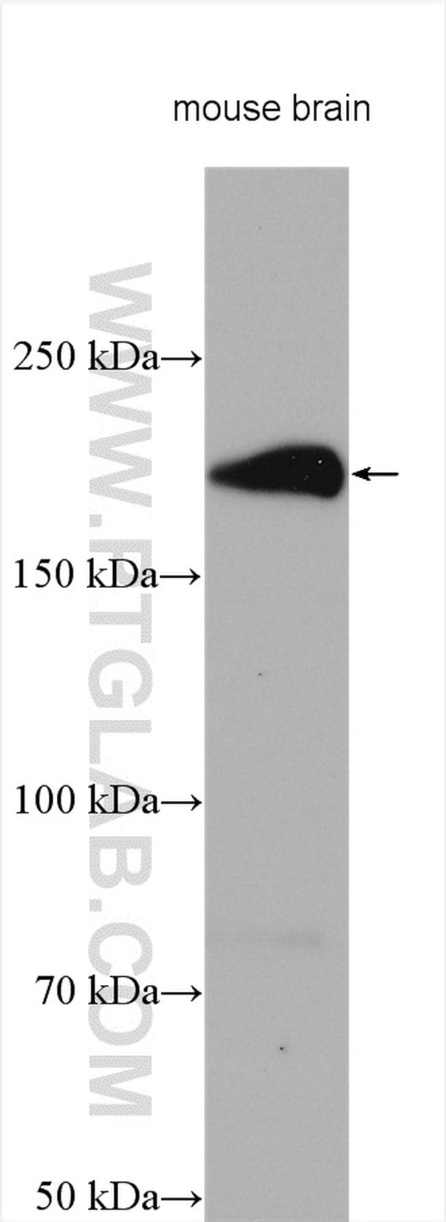 ADAMTS7 Antibody in Western Blot (WB)