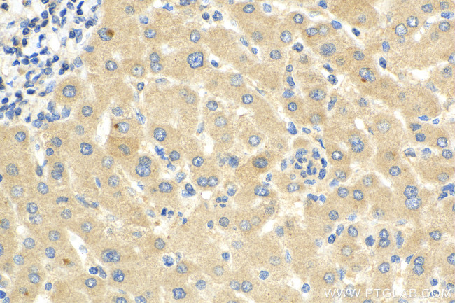 ADAMTS18 Antibody in Immunohistochemistry (Paraffin) (IHC (P))