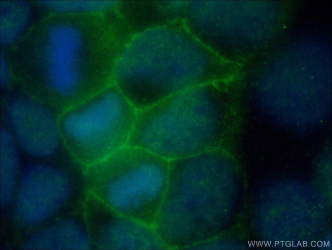 FLVCR1 Antibody in Immunocytochemistry (ICC/IF)