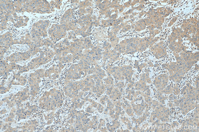 FLVCR1 Antibody in Immunohistochemistry (Paraffin) (IHC (P))