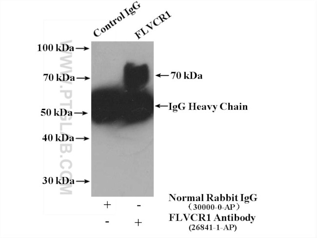 FLVCR1 Antibody in Immunoprecipitation (IP)