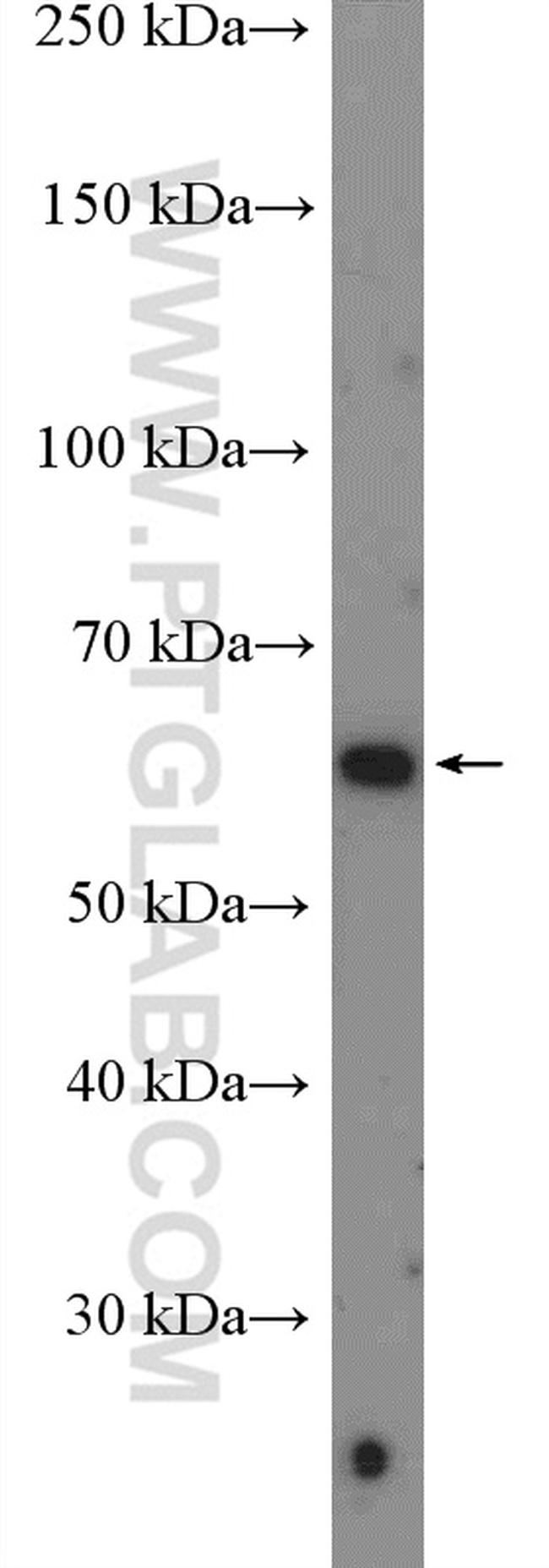 FLVCR1 Antibody in Western Blot (WB)