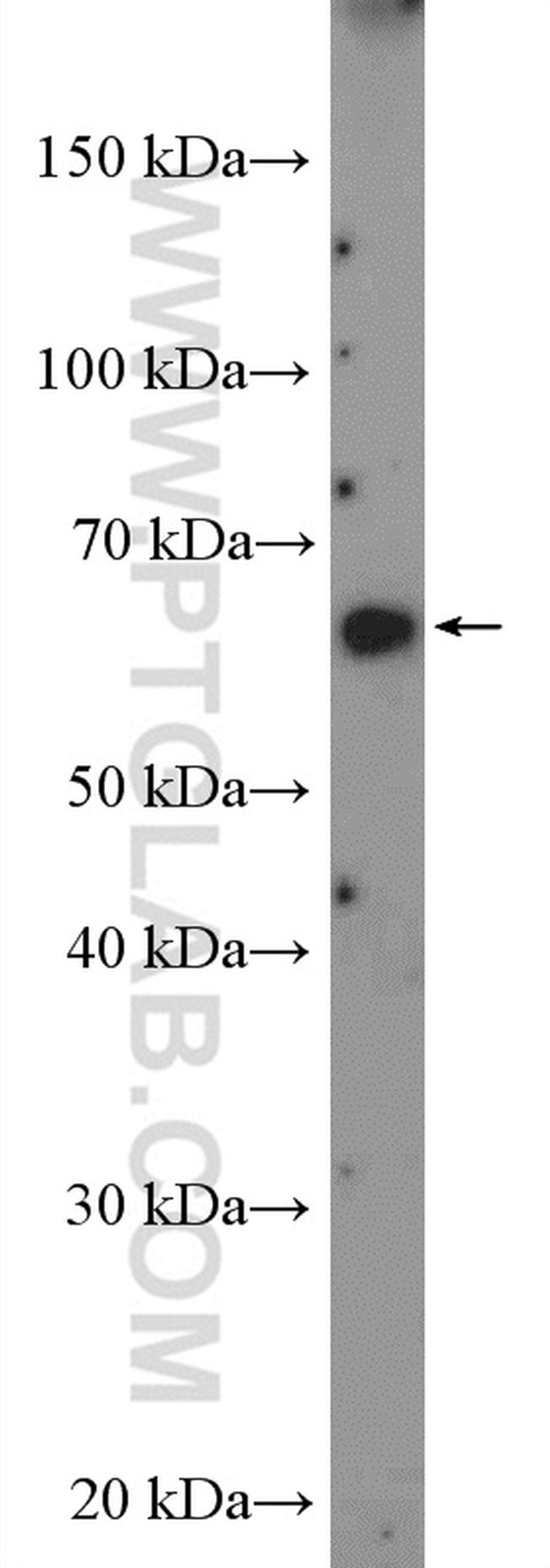 FLVCR1 Antibody in Western Blot (WB)