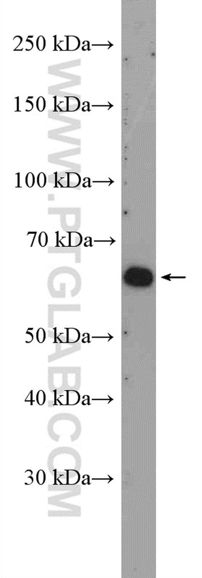 FLVCR1 Antibody in Western Blot (WB)