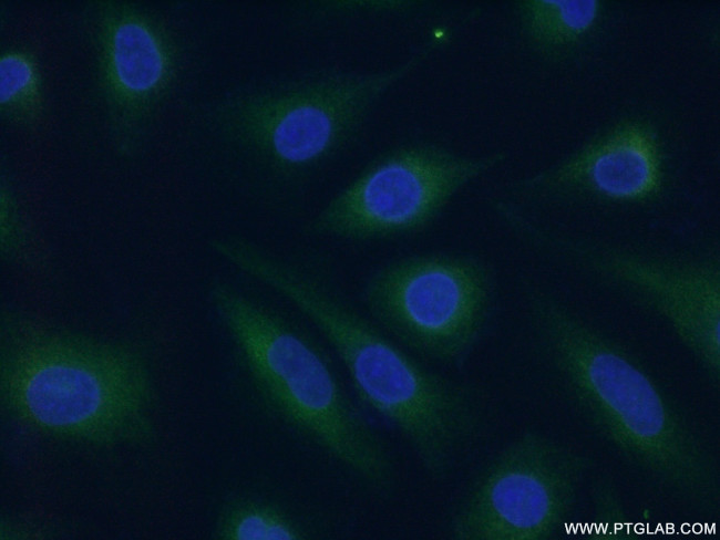 TRAF1 Antibody in Immunocytochemistry (ICC/IF)