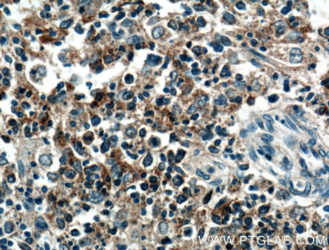 TRAF1 Antibody in Immunohistochemistry (Paraffin) (IHC (P))