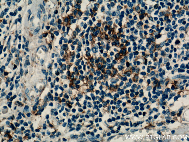 TRAF1 Antibody in Immunohistochemistry (Paraffin) (IHC (P))