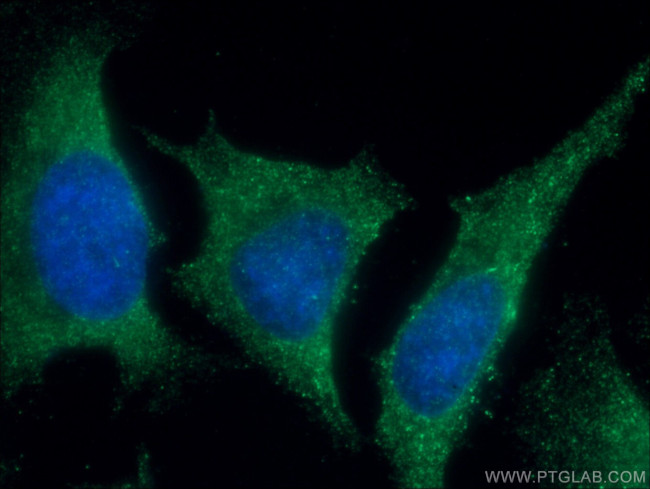 TRAF2 Antibody in Immunocytochemistry (ICC/IF)