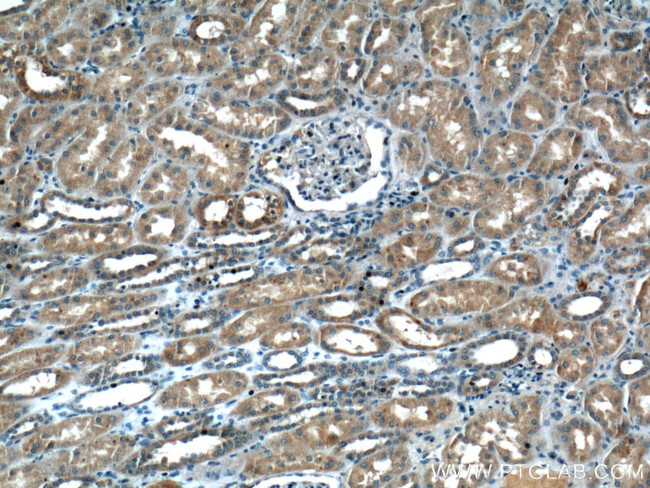 TRAF2 Antibody in Immunohistochemistry (Paraffin) (IHC (P))