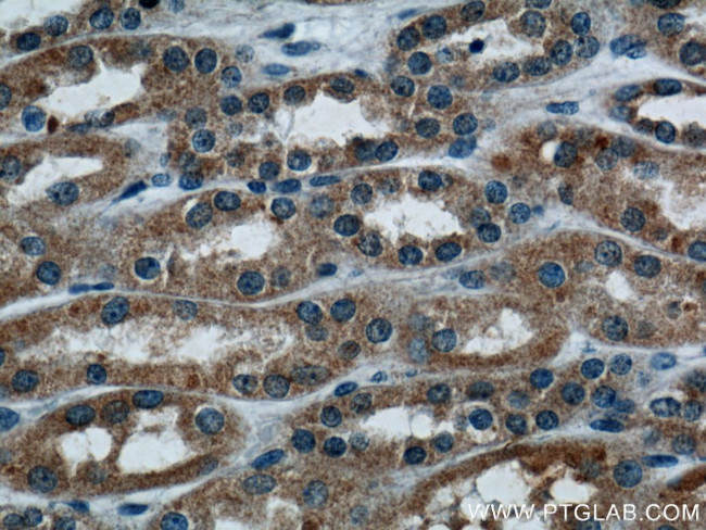 TRAF2 Antibody in Immunohistochemistry (Paraffin) (IHC (P))