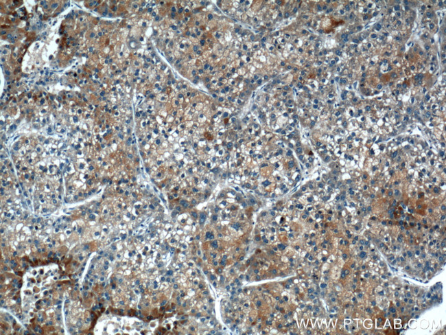 TRAF2 Antibody in Immunohistochemistry (Paraffin) (IHC (P))