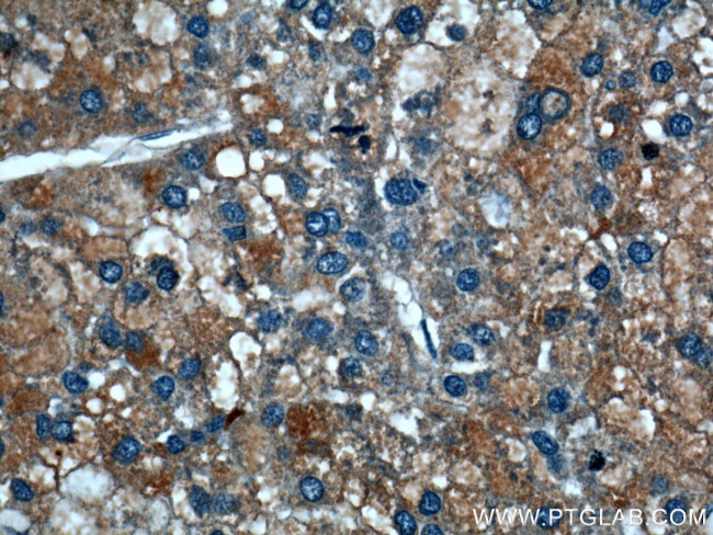 TRAF2 Antibody in Immunohistochemistry (Paraffin) (IHC (P))