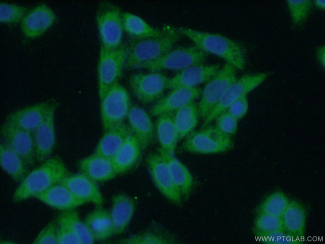 LTBP1 Antibody in Immunocytochemistry (ICC/IF)