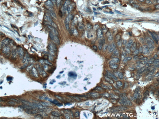 RAF1 Antibody in Immunohistochemistry (Paraffin) (IHC (P))