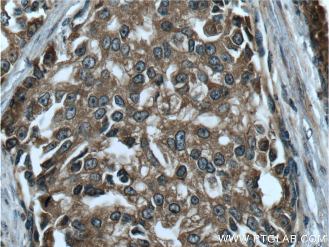 RAF1 Antibody in Immunohistochemistry (Paraffin) (IHC (P))