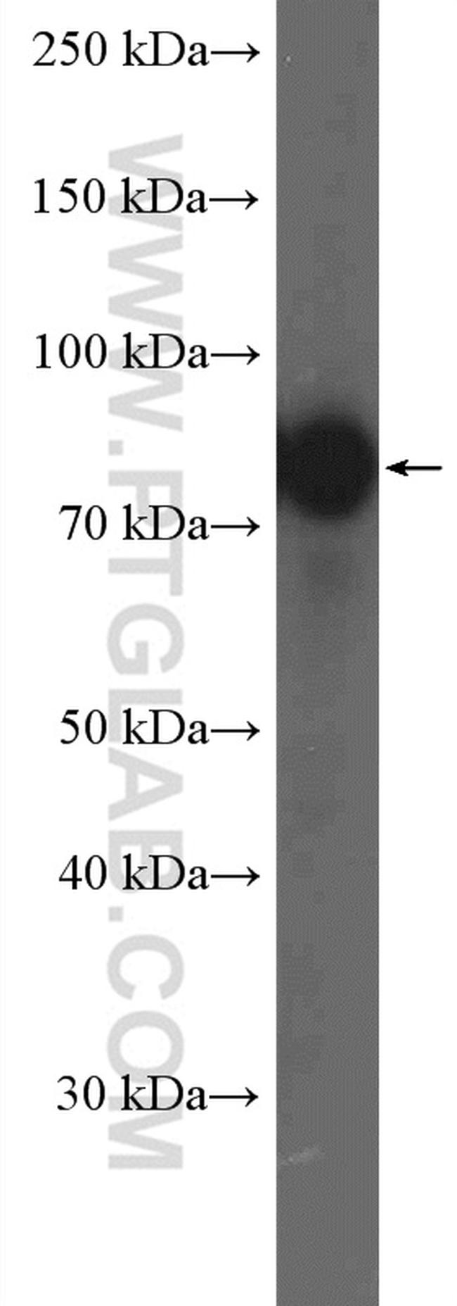 RAF1 Antibody in Western Blot (WB)