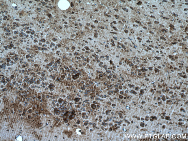 xCT Antibody in Immunohistochemistry (Paraffin) (IHC (P))