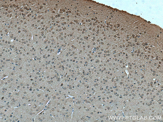 MYO9A Antibody in Immunohistochemistry (Paraffin) (IHC (P))