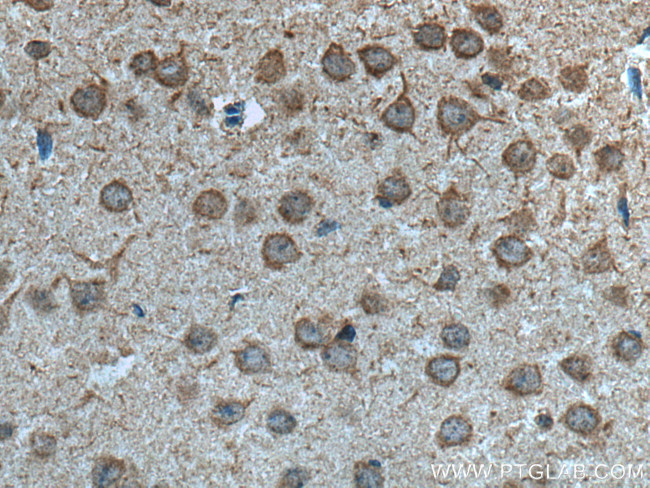 MYO9A Antibody in Immunohistochemistry (Paraffin) (IHC (P))