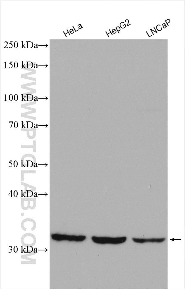 SLC35A3 Antibody in Western Blot (WB)