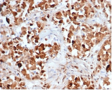 Growth Hormone Antibody in Immunohistochemistry (Paraffin) (IHC (P))