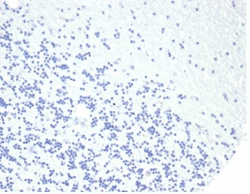 Growth Hormone Antibody in Immunohistochemistry (Paraffin) (IHC (P))