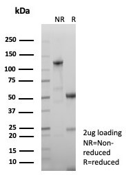 Growth Hormone (Pituitary Marker) Antibody in SDS-PAGE (SDS-PAGE)