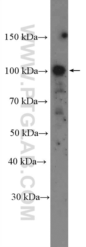 CNTROB Antibody in Western Blot (WB)