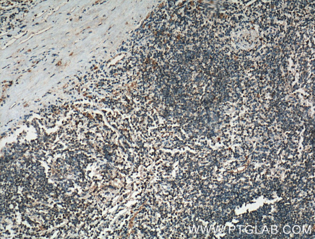 HGF alpha Antibody in Immunohistochemistry (Paraffin) (IHC (P))